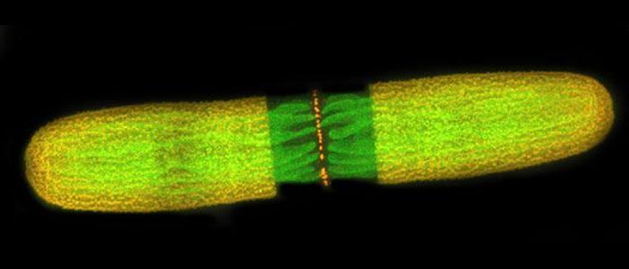 Confocal%20laser%20scanning%20microscopy%20image%3A%20penium