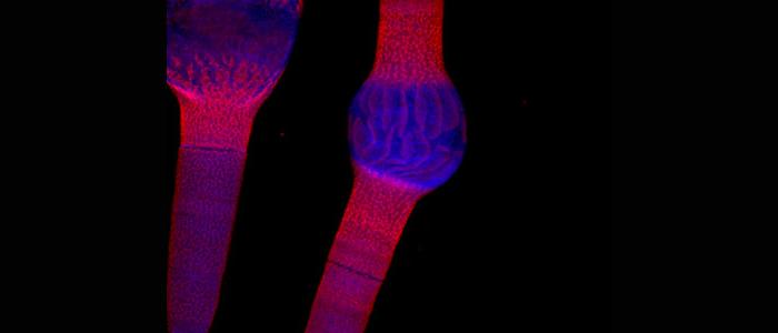 Confocal%20laser%20scanning%20microscopy%20image%3A%20Penium