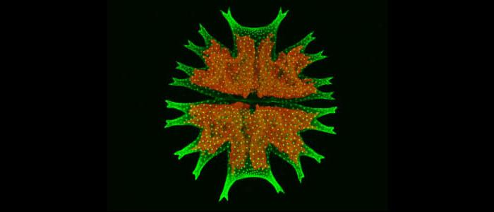 Confocal%20laser%20scanning%20microscopy%20image%3A%20Green%20alga%2C%20Micrasterias