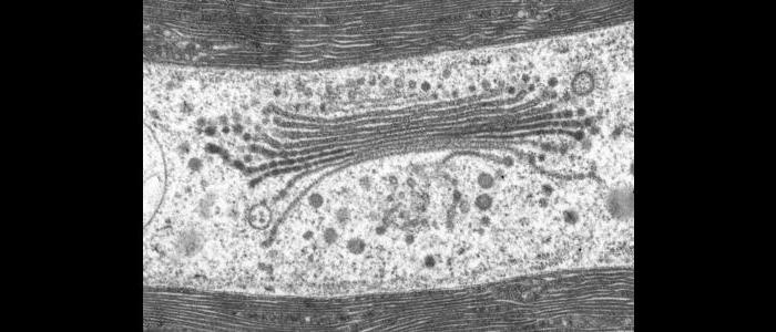 TEM%20Image%3A%20Golgi%20in%20Penium