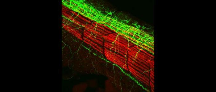 Confocal%20laser%20scanning%20microscopy%20image%3A%20Zebra%20fish%20neurons%20%28green%29%20and%20myosin%20%28red%29